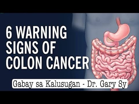 6 Warning Signs of Colon Cancer - Dr. Gary Sy