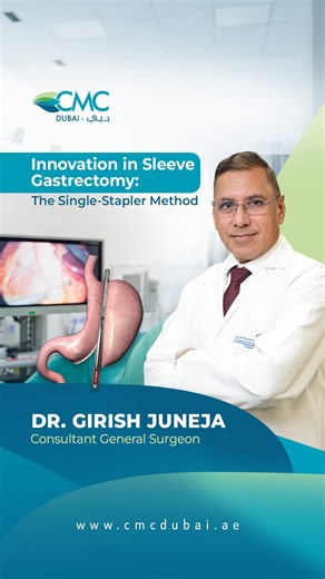 Clemenceau Medical Center Hospital on Instagram: "Looking for a permanent solution for weight loss? Dr. Girish Juneja introduces Single Stapler Sleeve Surgery, an advanced bariatric technique using one stapler line to reduce stomach size, offering fewer staples, less trauma, and faster recovery. To book a consultation call 800262392 . #SleeveSurgery #SleeveSurgeryDubai #WeightLossDubai #Dubai"