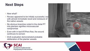 Deep Vein Arterialization: Step-by-Step Techniques