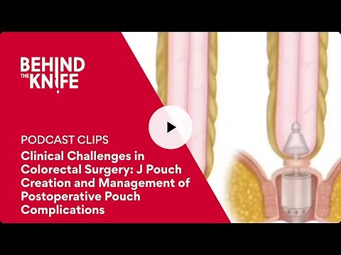 Clinical Challenges in Colorectal Surgery: J Pouch Creation and Postoperative Pouch Complications