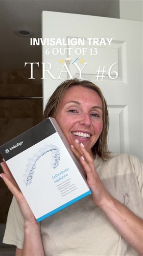 Invisalign Journey: New Aligner Night Experience