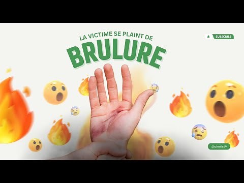 First aid training for workplace rescuers: the victim complains of burns