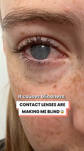 Contacts are making me blind. Here's how you prevent it from happening to you! 😱 | Happiest