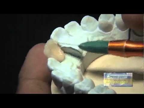 Resina Dental Nano Hybrid Prime Dent Dental Miami Usa