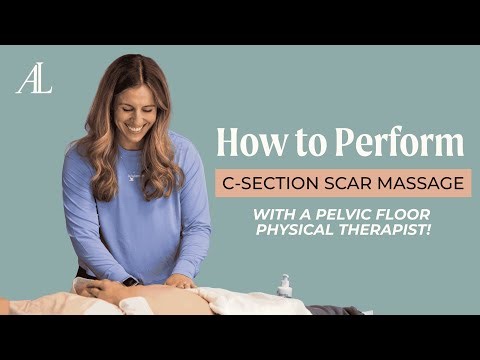 How to Perform C-Section Scar Massage