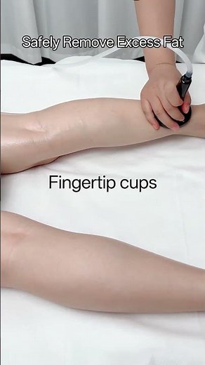 Relax & Detox: Watch This Satisfying Vacuum Therapy Session!