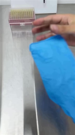 Understanding Urine Analysis: Key Insights