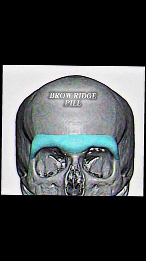 Exploring Lookism and Brow Ridge Concepts