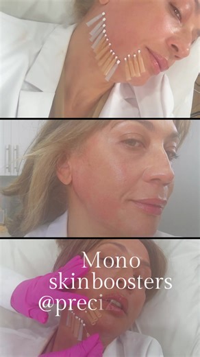 Mono threads snatch Aug $600 per area