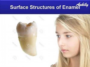 Enamel presentation part 3 (Dr Shamel & Ankily)