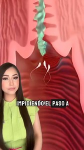 ¿Cómo funciona el implante subdérmico? ⬇️👩🏻‍⚕️ El implante subdérmico es una varilla flexible que contiene una hormona derivada de la progesterona. Es un anticonceptivo temporal altamente eficaz desde las 24 horas de su aplicación. Su efectividad es mayor al 99.5%. Una vez aplicado el implante hormonal subdérmico por personal médico capacitado, su efecto anticonceptivo dura 3 años. Si quieres saber cómo funcionan las inyecciones anticonceptivas sígueme para que no te pierdas mi próximo post. #