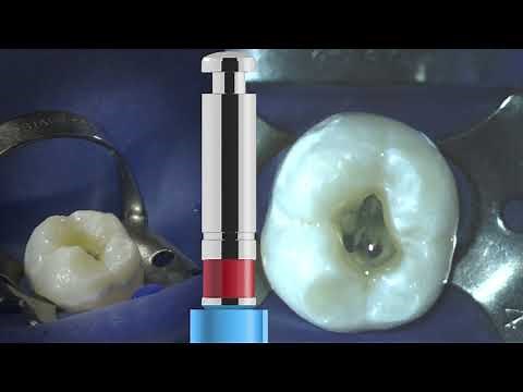 VDW Dental · VDW.ROTATE™ Basic Sequence (clinical video)