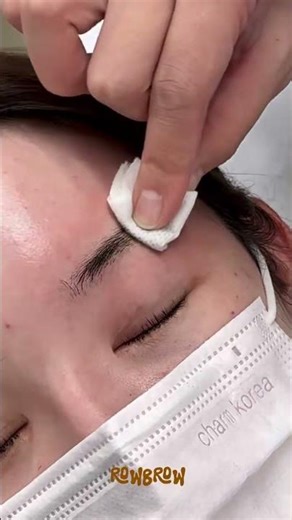 #반영구눈썹제거 #browcorrection #browtattooremoval #눈썹문신제거 #눈썹잔흔제거