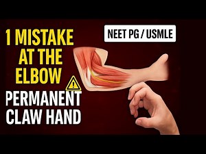 Ulnar Nerve Injuries Explained | Causes, Symptoms, Claw Hand, Froment Sign & Ulnar Paradox