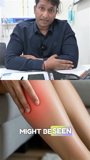 Swollen, Painful Legs? It Could Be DVT! (Deep Vein Thrombosis) #drbalajipatelkola #doctor