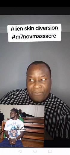 Alien Skin Diversion: Trending News and Updates