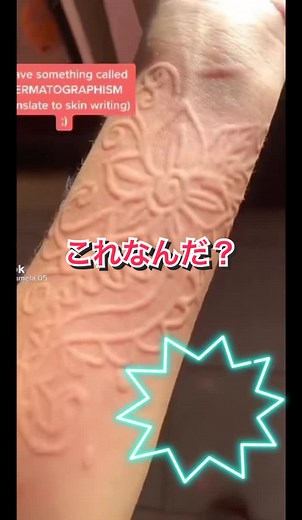 皮膚科専門医が教える蕁麻疹の原因と対処法