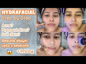 HYDRAFACIAL: Step-by-Step | Is this WORTH it? (Before & After Results) + Pricing