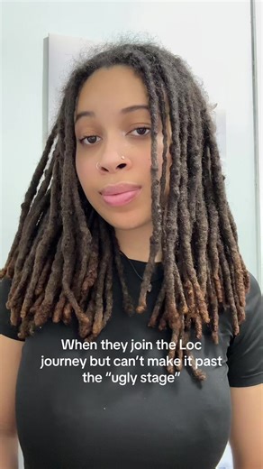 Overcoming the Ugly Stage in Your Loc Journey