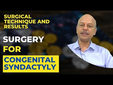 Surgery for Congenital Syndactyly: The preparation, the technique, the results and much, much more!