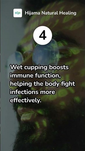 Five benefits of Hijama cupping therapy you should know!