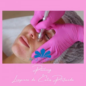 Dale a tu piel una renovación completa con nuestro Peeling con Punta de Diamante. 💎✨Verás resultados desde la primera sesión! Citas al wa.me/595961281515 📲 #PeelingDiamante #belleza #cuidadodelapiel #facial #cosmetologia #microdermoabrasion #radiofrecuencia #hidrofacial #laser #tratamientoscorporales #paraguay | Acqua Dolce Spa Urbano
