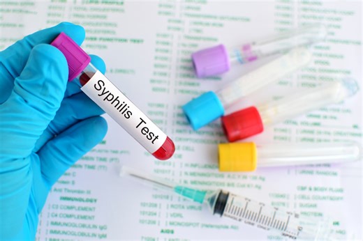 Which At-Home STD Test Should You Buy? Start Here.