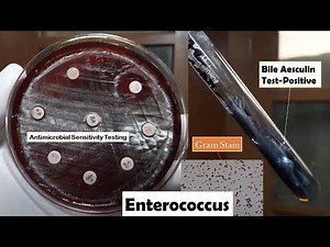 Enterococcus Antibiotics sensitivity testing, bile esculin positive and Gram staining