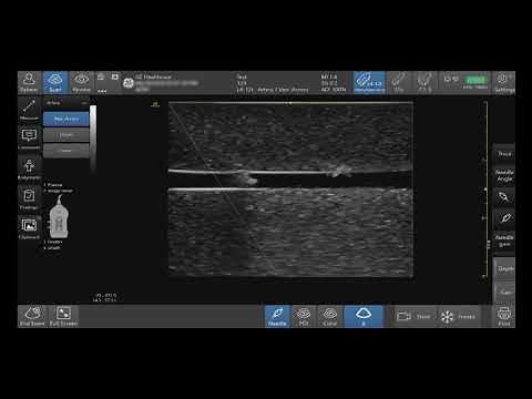 Venue Family Tutorials: Needle Visualization