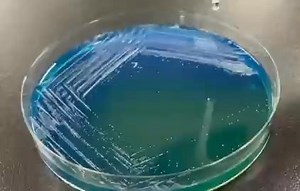 𝗣𝗥𝗨𝗘𝗕𝗔 𝗗𝗘 𝗖𝗔𝗧𝗔𝗟𝗔𝗦𝗔 🧫 La catalasa es una enzima que se encarga de descomponer el peróxido de hidrógeno en agua y oxígeno. Esta prueba se utiliza para detectar si una bacteria produce catalasa, ya que muchas bacterias aerobias y anaerobias facultativas que poseen citocromo oxidasa también la contienen. 𝗣𝗿𝗼𝗰𝗲𝗱𝗶𝗺𝗶𝗲𝗻𝘁𝗼: Sobre un portaobjetos se colocan una o dos gotas de agua oxigenada, y luego se toca con ella una colonia del microorganismo que se desea analizar. Para t