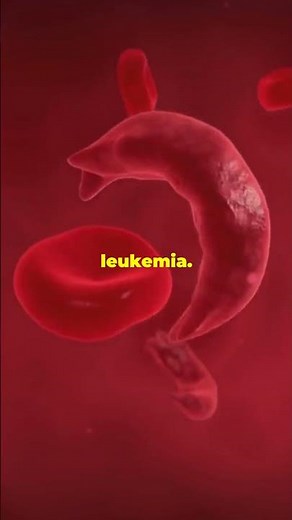 Hydroxyurea What You Need to Know! #health #fyp #hydroxyurea #trending #medicaladvancements