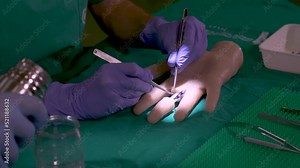 4K Real Time - Practice of a surgery using the laparoscopy technique - details of needles, gloves, microscope...