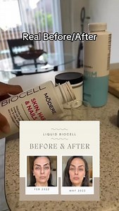 ️ Me + a customer, before & after three months on Liquid BioCell Life+. Smoother skin, less stiffness, and no foundation here! Want to see what it can do for you? Message me “START.” #usa #canadá #australia #canada #mylifebydesign #sidehustle #collagenlife #extraincome #financialfreedom #networking #liquidgold #wellnessjourney | Mahnoush Malekzadeh | Facebook