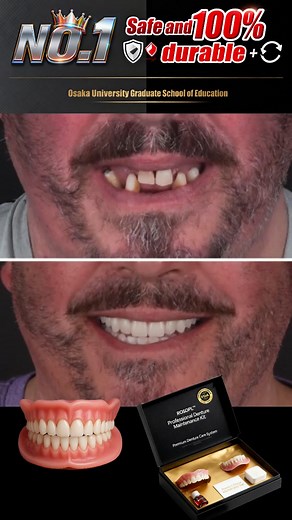 Traditional dentures often lead to bone loss and facial sagging over time. - ​Dr.Scully, DDS Premium Custom Full Denture Sets are different. Designed by dental experts, they deliver a customized, stable fit without the discomfort of traditional dentures. ✨ Supports facial structure ✨ Feels natural and secure ✨ No adhesive required Recommended by professionals. Loved by users. 👉 Discover why more patients are choosing Premium Custom Full Denture Sets today. | Dr.Scully