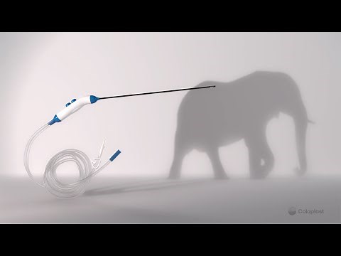 ELEFANT by Coloplast - suction and irrigation device in laparoscopy