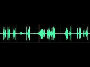 Stridor (Laryngomalacia in Infant)