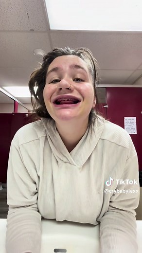 Gum Healing Progress After Tooth Extraction