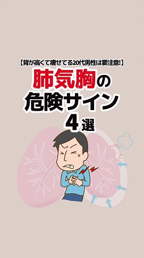 肺気胸の危険サイン4選
