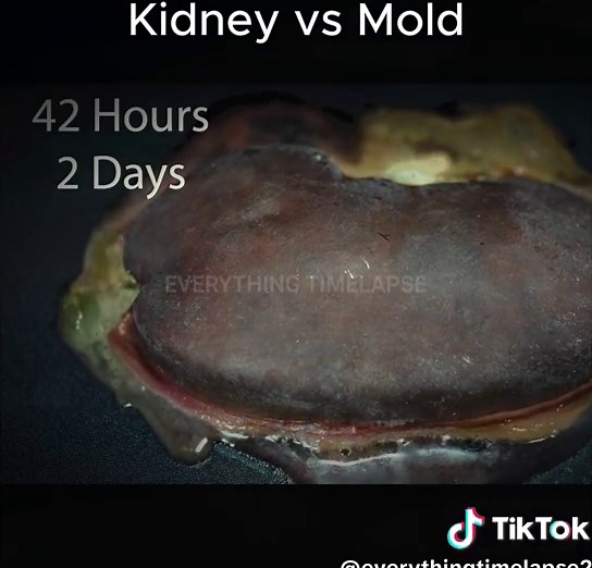Kidney Time Lapse - Rotting Time Lapse #timelapse #foodtimelapse #fyp #beef #mold #everythingtimelapse #kidney