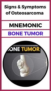 Signs & Symptoms of Osteosarcoma Medical Mnemonics
