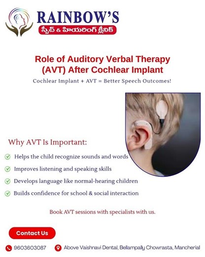 Role of Auditory Verbal Therapy (AVT) After Cochlear Implant | Better Speech Outcomes