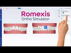 Planmeca Romexis® Ortho Simulator