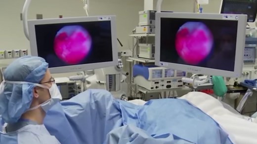Benefits of Blue Light Cystoscopy with Cysview