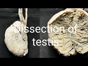 Testis | Anatomy of testis| Dissection of testis |viva practical testis| position of testis