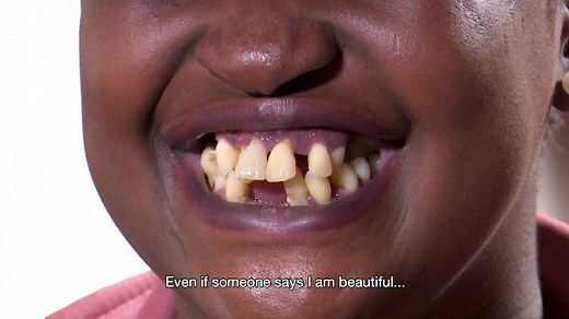 Thozama lost her teeth because of a sickness and that led toher lossing her job because of how she looks. #BringBackMySmile Sat at 20h00 on Moja LOVE DStv CH 157 | Moja Love TV
