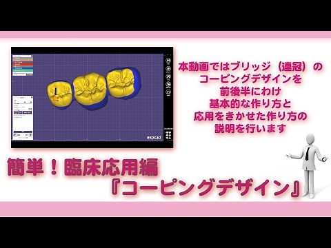 【exocad】簡単！臨床応用編『コーピングデザイン』【歯科技工士】