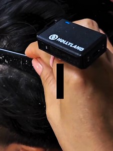 Dandruff hair scalp on the cleaning #DandruffScratching #ItchyDryScalp #HugeFlakes #Dandruff #dandrufftreatment #satisfying #dandruffremoval Disclaimer: Videos do not show original Dandruff, they are used for education purpose. Thank You,,,, | The Filmy