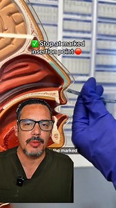 ¿Cómo se coloca una SONDA NASOGÁSTRICA? #SondaNasogastrica | Dr. Zamora en VIVO