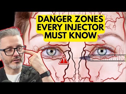 The Most Dangerous Injection Zones in the Face, And the Anatomy You MUST Know to Avoid Them