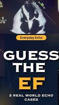 Guess the Ejection Fraction: Test Your Echocardiography Skills. #echocardiography #ultrasound #echo